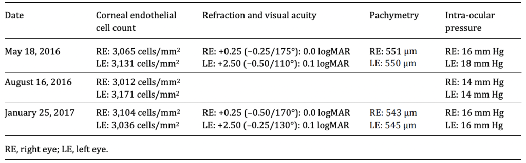 Table 1. Optical coherence tomography pachymetry 8 months after the procedure